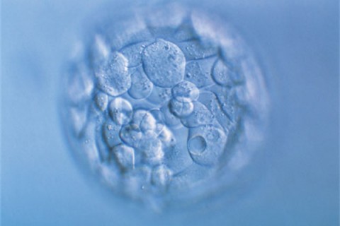 http://dalian.quanwangkm.com/post/190.html|大连人工试管